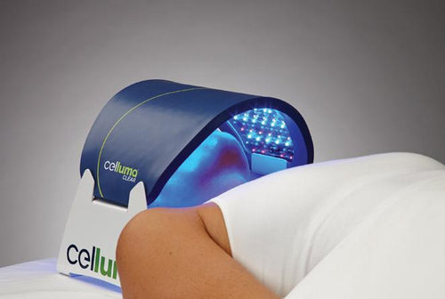 Celluma LED - Acne Clear